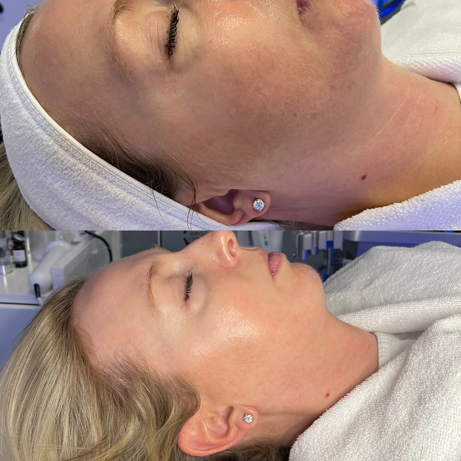 Before and after skincare result showing calmer, more luminous skin
