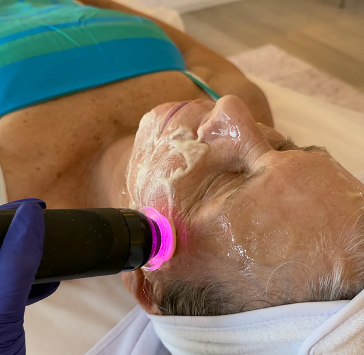 Glo2Facial treatment with OxyGeneo device during active infusion